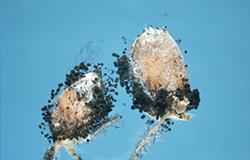 First clinical guidelines for chronic fungal lung infections