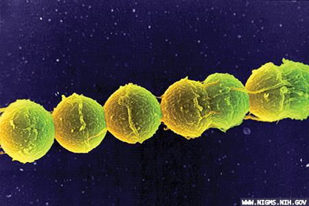 Calls for better guidance on Group B Strep 