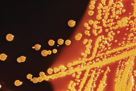 Strategies to reduce surgical site infection 