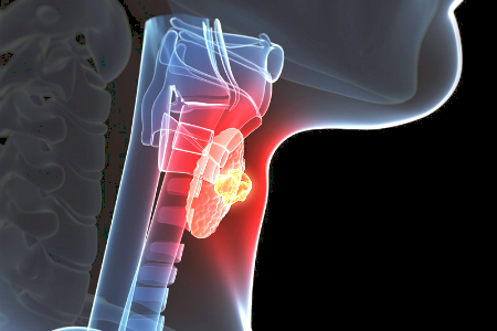 Thyroid cancer patients to have routine access to alternative treatments