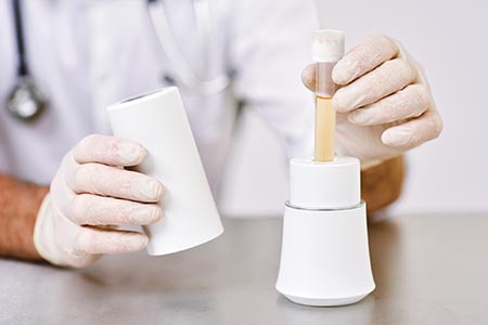 A step change in point-of-care urine testing
