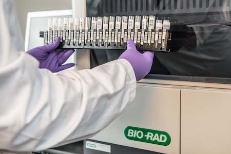 Bio-Rad accelerates production of antibody test