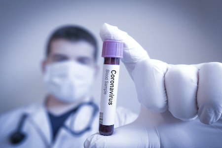Common cancer treatments ‘do not worsen coronavirus infection’