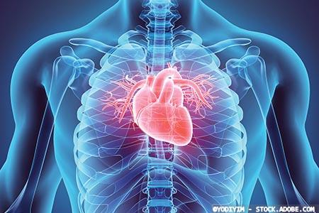 COVID-19 linked with higher death rate in acute heart failure patients