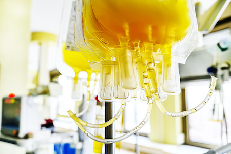 Blood plasma treatment has limited effect for sickest COVID patients