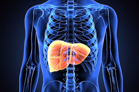 NICE recommends SIRT therapy for advanced liver cancer