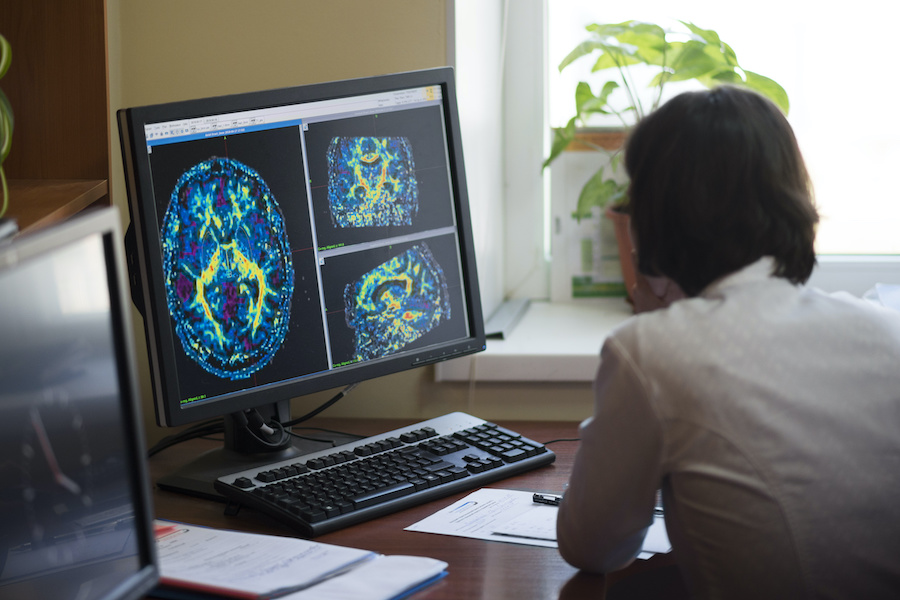 NHS needs thousands more radiologists to keep patients safe