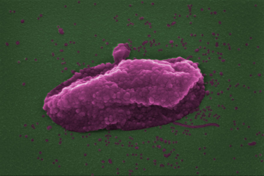 ‘Last resort’ antibiotic pops bacteria like balloons 