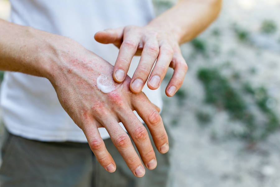 Almost half of people in Europe have a skin problem or disease