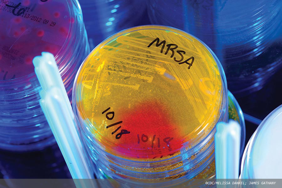 POC testing of trauma patients for MRSA