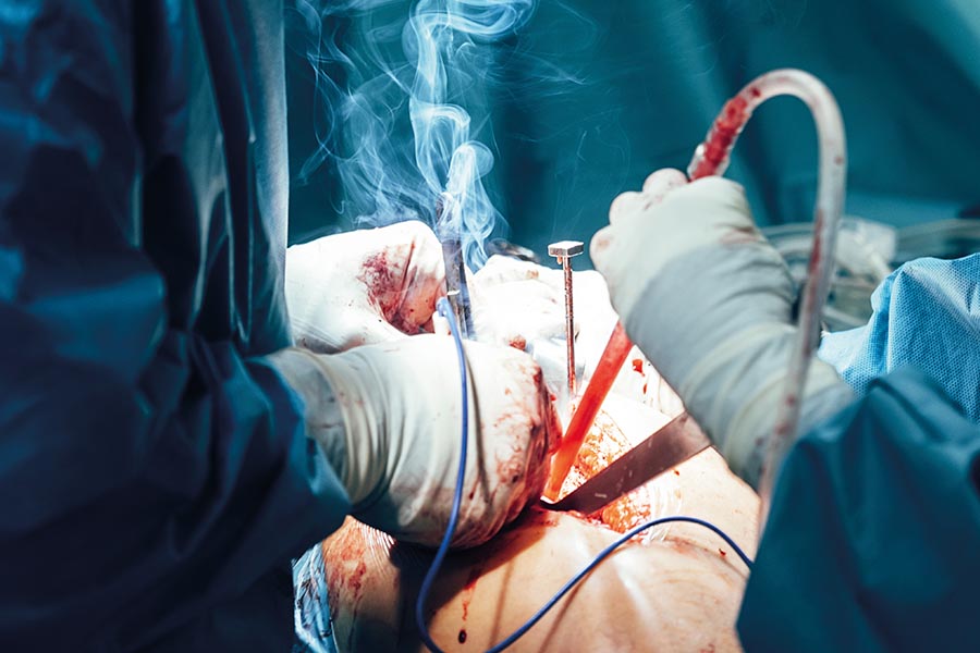 Surgical smoke: the  microbiological risks 