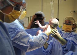 Caesarean infection rate at nearly 10%