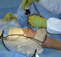 Infection control in orthopaedic surgery