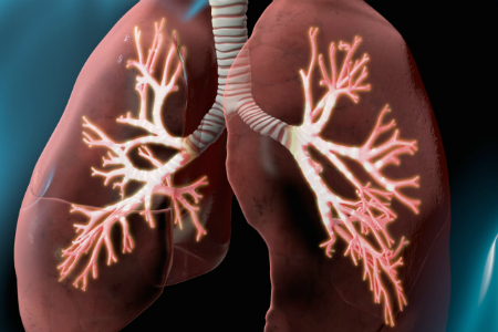 £100m programme to transform care for people living with chronic lung conditions