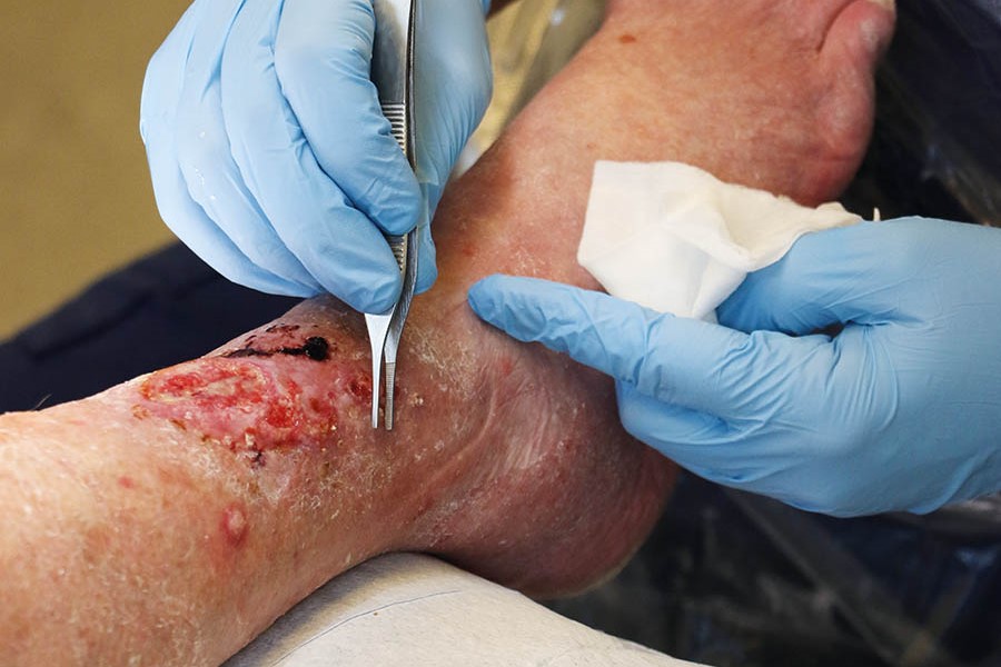 Wound care in the wake  of the pandemic