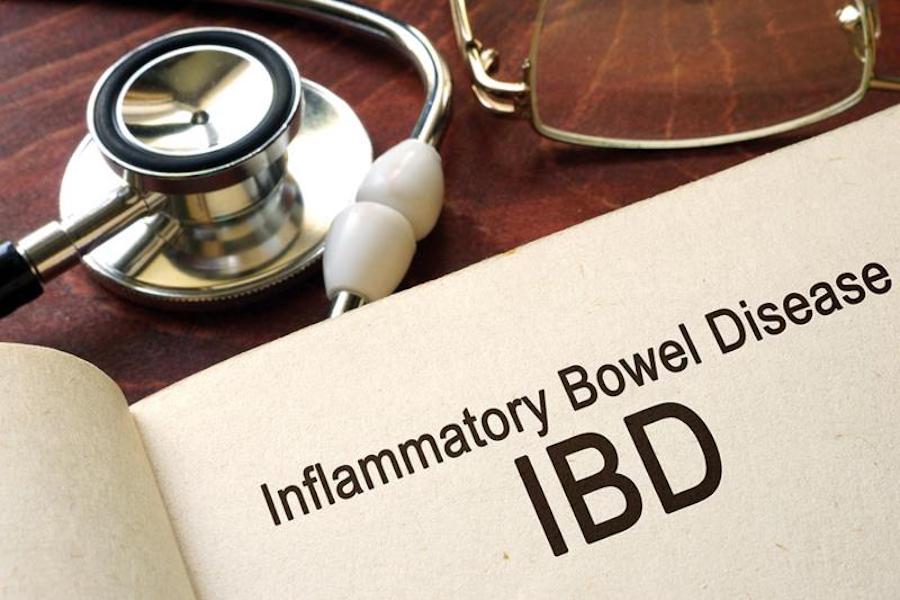 FREE webinar on treatment of inflammatory bowel disease