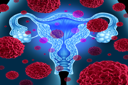 New method could improve cervical cancer screening