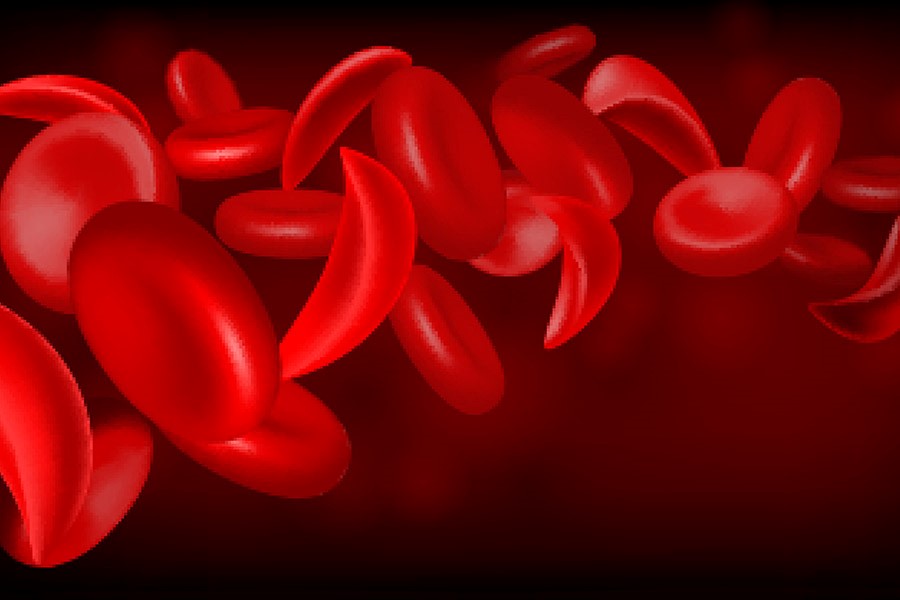 Sickle cell patients to get better treatment after £9 million boost