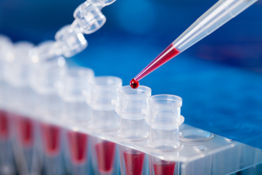 Boost for clinical trials under 10 Year Health Plan