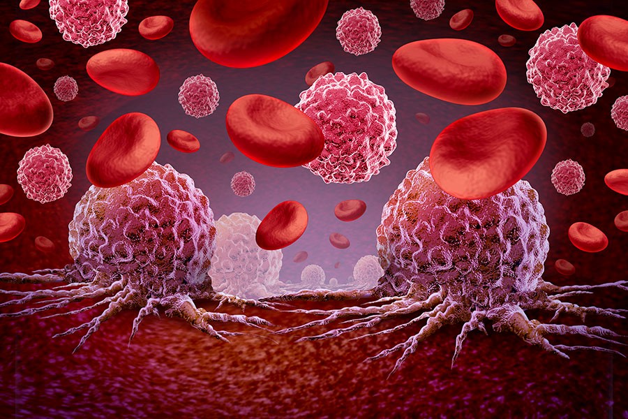 A breath test could help us detect blood cancers