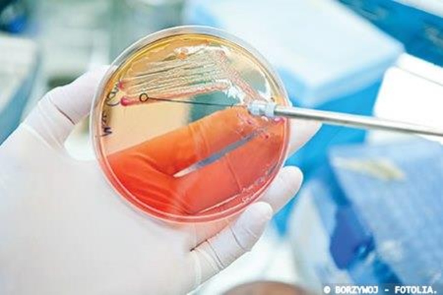 Antibiotic resistant bacteria found in malnourished children under five years old