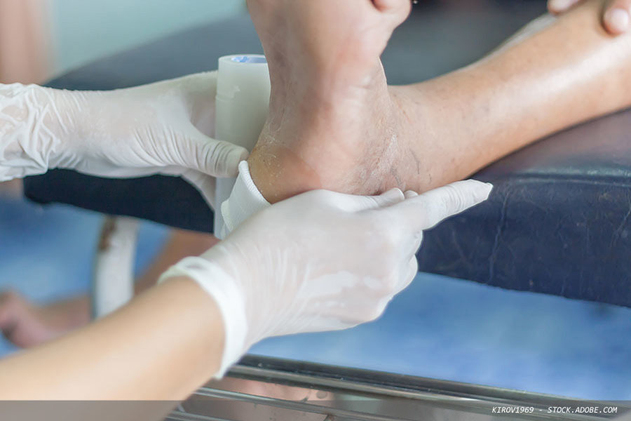 Advancing wound debridement practice